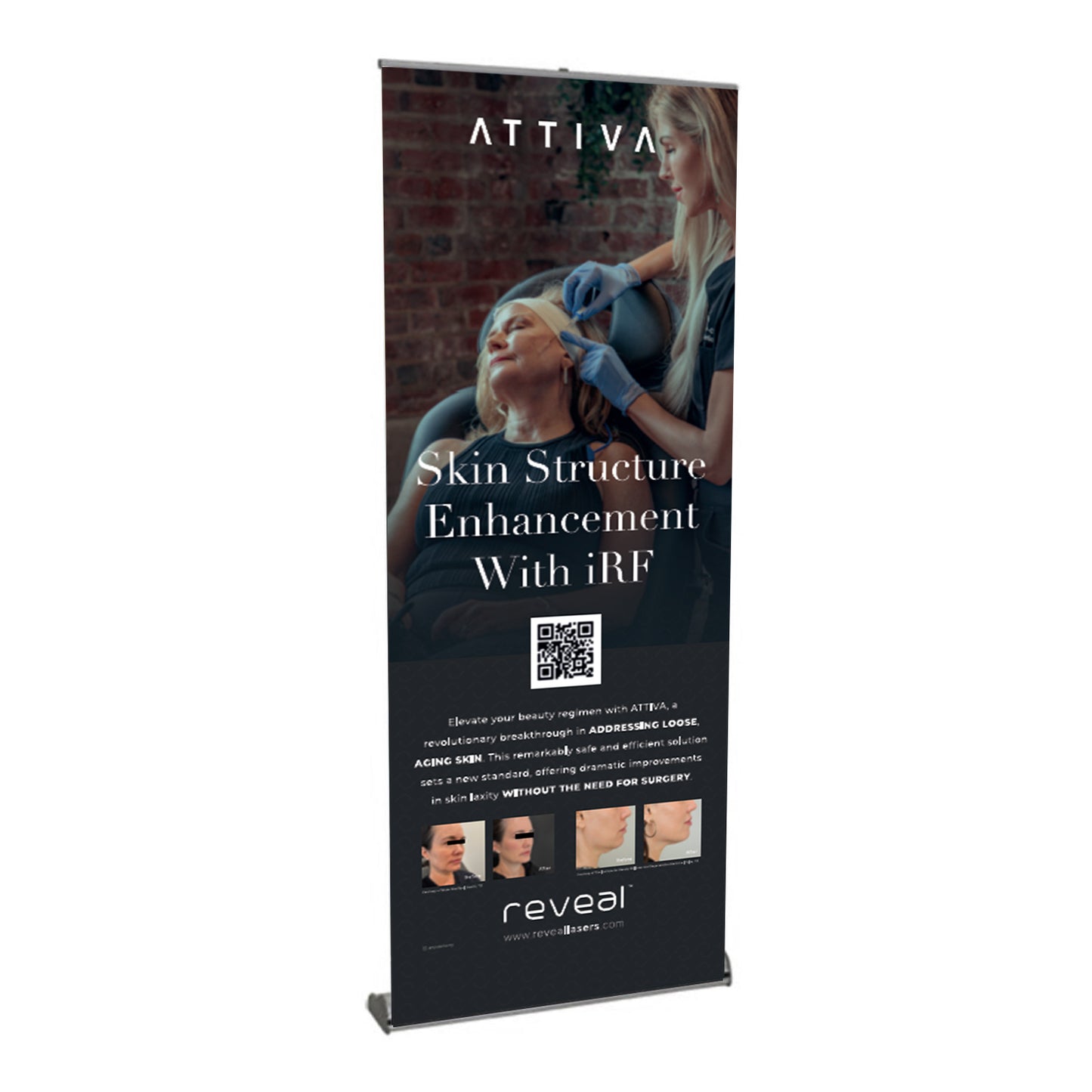 Attiva Banner Stand